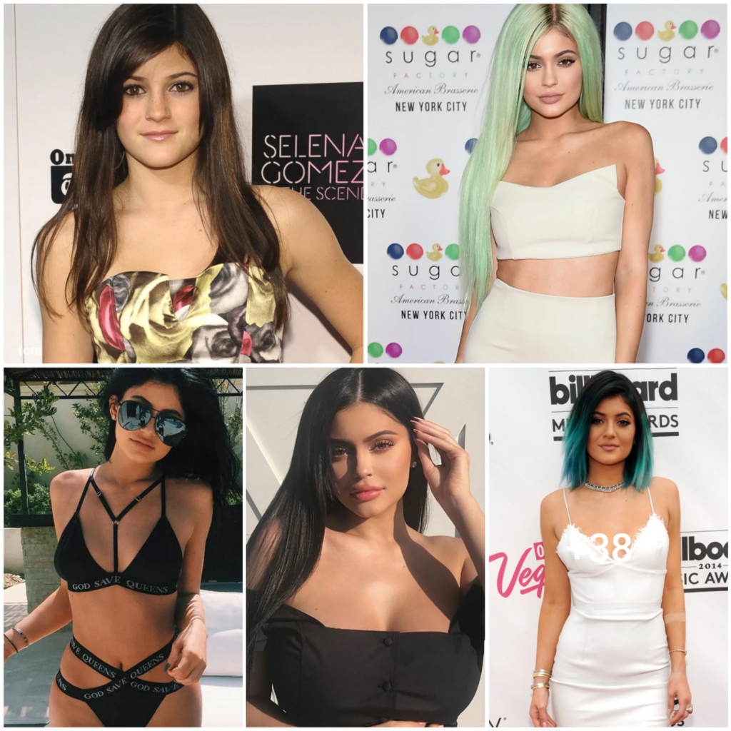 From Lip Kits to Billionaire Status: The Incredible Transformation of Kylie Jenner
